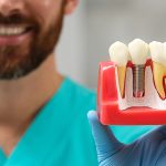 Dental implant dentists serving Cadillac MI - life smiles dentistry