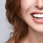 Smile Makeover- life smiles dentistry