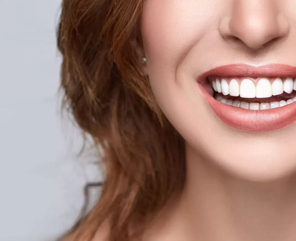 Smile Makeover- life smiles dentistry